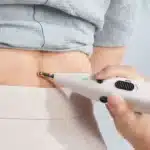 Stylo électrique acupuncture 2